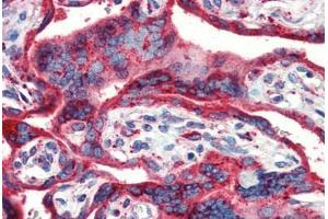 Human Placenta (formalin-fixed, paraffin-embedded) stained with HSP90B1 antibody ABIN462106 at 10 ug/ml followed by biotinylated secondary antibody, alkaline phosphatase-streptavidin and chromogen. (GRP94 Antikörper)