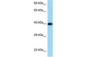 Image no. 1 for anti-CD72 Molecule (CD72) (AA 273-322) antibody (ABIN6748123) (CD72 Antikörper  (AA 273-322))