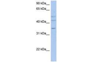 Image no. 1 for anti-PXYLP1 / ACPL2 (AA 71-120) antibody (ABIN6743334) (PXYLP1 / ACPL2 (AA 71-120) Antikörper)