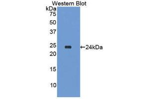 Western Blotting (WB) image for anti-Amyloid P Component, Serum (APCS) (AA 20-223) antibody (ABIN1174754) (APCS Antikörper  (AA 20-223))