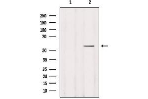Western blot analysis of extracts from Hela, using DFNA5 Antibody. (DFNA5 Antikörper  (C-Term))