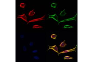ABIN6264064 and ABIN6277250 staining Hela cells by IF/ICC.
