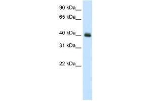WB Suggested Anti-PUS1 Antibody Titration:  0. (PUS1 Antikörper  (C-Term))