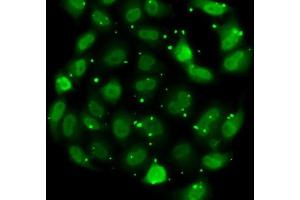 Immunofluorescence analysis of MCF7 cells using DR1 antibody (ABIN6130316, ABIN6139817, ABIN6139819 and ABIN6217241). (DR1 Antikörper  (AA 1-176))