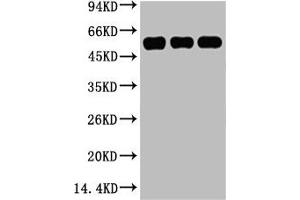 Western blot analysis of 1) Hela, 2) Mouse Kidney tissue, 3) Rat Heart tissue, diluted at 1:5000. (TUBB3 Antikörper)