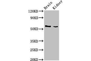Western Blot Positive WB detected in: Mouse brain tissue, Mouse kidney tissue All lanes: SLC25A23 antibody at 3 μg/mL Secondary Goat polyclonal to rabbit IgG at 1/50000 dilution Predicted band size: 53, 50, 55, 49 kDa Observed band size: 53 kDa (SLC25A23 Antikörper  (AA 1-188))