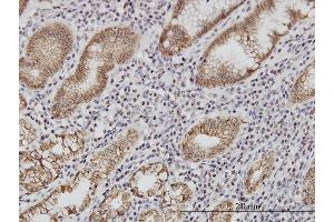 Immunostaining (ISt) image for anti-Cadherin 1, Type 1, E-Cadherin (Epithelial) (CDH1) (AA 381-480) antibody (ABIN560274)