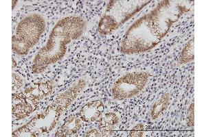 Immunoperoxidase of monoclonal antibody to CDH1 on formalin-fixed paraffin-embedded human stomach. (E-cadherin Antikörper  (AA 381-480))