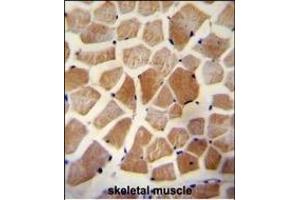 WISP2 Antibody (Center) A immunohistochemistry analysis in formalin fixed and paraffin embedded human skeletal muscle followed by peroxidase conjugation of the secondary antibody and DAB staining. (WISP2 Antikörper  (AA 87-116))