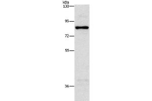 Western Blot analysis of Hela cell using NOL9 Polyclonal Antibody at dilution of 1:1250 (NOL9 Antikörper)