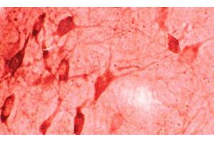 Immunohistochemistry analysis using Rabbit Anti-HO-1 Polyclonal Antibody . (HMOX1 Antikörper)