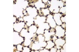 Immunohistochemistry of paraffin-embedded mouse lung using E2F6 antibody (ABIN5973627) at dilution of 1/200 (40x lens). (E2F6 Antikörper)