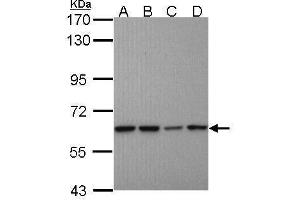 WB Image Sample (30 ug of whole cell lysate) A: A431 , B: H1299 C: Hela D: Hep G2 , 7. (Proteasome 26S S3 (Center) Antikörper)