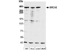 anti-Breast Cancer 2, Early Onset (BRCA2) (AA 450-500) antibody