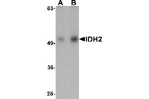 Western Blotting (WB) image for anti-Isocitrate Dehydrogenase 2 (NADP+), Mitochondrial (IDH2) (N-Term) antibody (ABIN1031407) (IDH2 Antikörper  (N-Term))