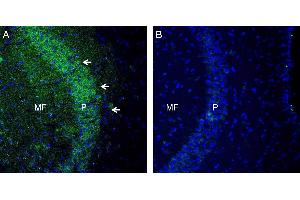 Expression of TSH Receptor in mouse hippocampus. (TSH receptor Antikörper  (Extracellular, N-Term))