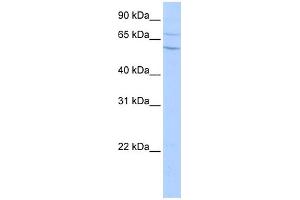 WB Suggested Anti-CPN2 Antibody Titration: 0. (CPN2 Antikörper  (N-Term))