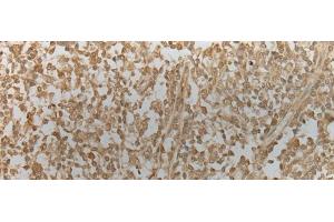 Immunohistochemistry of paraffin-embedded Human tonsil tissue using ZNF8 Polyclonal Antibody at dilution of 1:40(x200) (ZNF8 Antikörper)