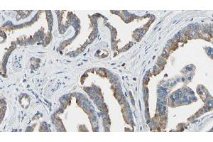ABIN6277658 at 1/100 staining Human prostate tissue by IHC-P. (TK1 Antikörper  (N-Term))