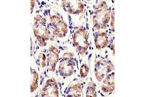Immunohistochemistry (Paraffin-embedded Sections) (IHC (p)) image for anti-Protein Kinase C and Casein Kinase Substrate in Neurons 2 (PACSIN2) (AA 342-371), (C-Term) antibody (ABIN392666)