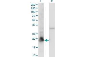 Western Blot analysis of PPIL1 expression in transfected 293T cell line by PPIL1 monoclonal antibody (M01), clone 2C2. (PPIL1 Antikörper  (AA 76-166))