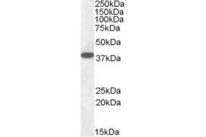 Image no. 1 for anti-Epilepsy, Progressive Myoclonus Type 2A, Lafora Disease (Laforin) (EPM2A) (Internal Region), (Isoform A) antibody (ABIN375087) (EPM2A Antikörper  (Internal Region, Isoform A))