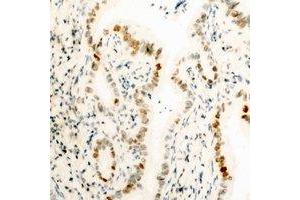 Immunohistochemical analysis of HMGB1 staining in human kidney formalin fixed paraffin embedded tissue section. (HMGB1 Antikörper  (N-Term))