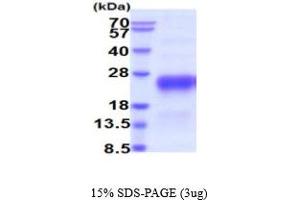 SDS-PAGE (SDS) image for Chorionic Gonadotropin, beta Polypeptide 3 (CGB3) (AA 21-165) protein (His tag) (ABIN5854819) (Chorionic Gonadotropin, beta Polypeptide 3 (CGB3) (AA 21-165) protein (His tag))