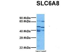 Host:  Rabbit  Target Name:  SLC6A8  Sample Tissue:  Human MDA-MB-435s, Human THP-1  Antibody Dilution:  1.