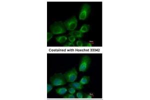 ICC/IF Image Immunofluorescence analysis of paraformaldehyde-fixed A431, using UBE2B, antibody at 1:500 dilution. (UBE2B Antikörper)