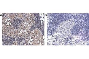Immunohistochemical staining of human lymphnode tissue using A) anti-IL-33 (human), pAb  and B) anti-rabbit IgG (negative control) . (IL-33 Antikörper)