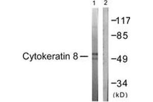 Western blot analysis of extracts from 293 cells, treated with EGF 200ng/ml 30', using Keratin 8 (Ab-431) Antibody. (KRT8 Antikörper  (AA 401-450))