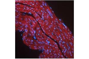 Immunofluorescent IGF1R detection in mouse skeletal muscle (red fluorescence). (IGF1R Antikörper  (Middle Region))