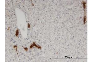 Immunoperoxidase of monoclonal antibody to CAPN9 on formalin-fixed paraffin-embedded human liver. (Calpain 9 Antikörper  (AA 591-690))