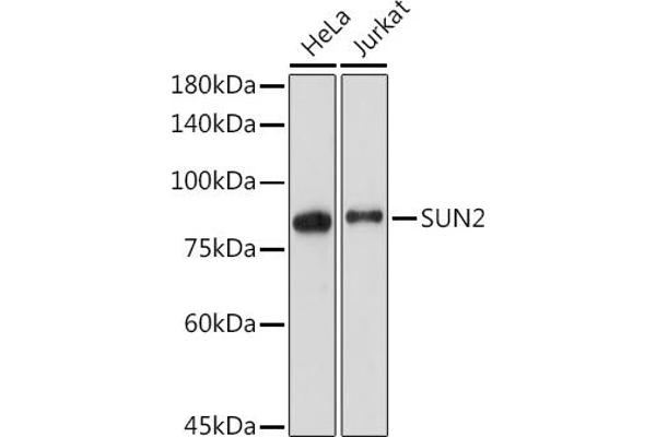 SUN2 抗体
