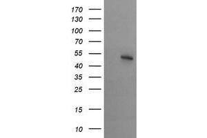 Image no. 3 for anti-serine/threonine Kinase 38 Like (STK38L) (AA 1-281) antibody (ABIN1490700) (STK38L Antikörper  (AA 1-281))