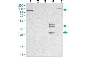 Western blot analysis of Lane 1: RT-4, Lane 2: U-251 MG, Lane 3: Human Plasma, Lane 4: Liver, Lane 5: Tonsil with ESPN polyclonal antibody . (Espin Antikörper)