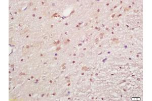 Formalin-fixed and paraffin embedded rat brain labeled with Anti-phospho-MAPKAPK5(Ser93)Polyclonal Antibody, Unconjugated (ABIN710561) at 1:200, followed by conjugation to the secondary antibody and DAB staining (MAPKAP Kinase 5 Antikörper  (pSer93))