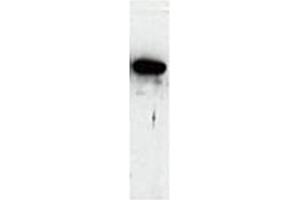 Western Blot of Cell lysate from Human using PADI antibody Cat. (Peptidylarginine Deiminase Antikörper)