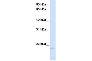 C14ORF180 antibody used at 1 ug/ml to detect target protein. (C14orf180 Antikörper  (Middle Region))