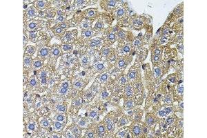 Immunohistochemistry of paraffin-embedded Mouse liver using CETP Polyclonal Antibody (CETP Antikörper)