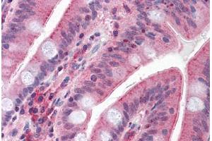 Anti-CDHR5 / MUPCDH antibody  ABIN960757 IHC staining of human small intestine.