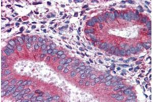 Human Uterus: Formalin-Fixed, Paraffin-Embedded (FFPE) (Calnexin Antikörper  (AA 204-218))