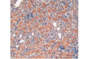 Detection of MMP12 in Rat Kidney Tissue using Polyclonal Antibody to Matrix Metalloproteinase 12 (MMP12) (MMP12 Antikörper  (AA 20-99))