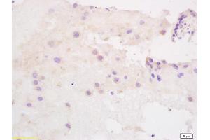 Formalin-fixed and paraffin embedded human placenta labeled with Anti SLC40A1/FPN1 Polyclonal Antibody, Unconjugated (ABIN1387819) at 1:200 followed by conjugation to the secondary antibody and DAB staining (SLC40A1 Antikörper  (AA 331-430))
