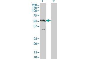 Western Blot analysis of MAP2K7 expression in transfected 293T cell line by MAP2K7 monoclonal antibody (M07), clone 2C12. (MAP2K7 Antikörper  (AA 1-99))