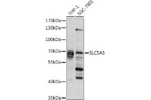 Western blot analysis of extracts of various cell lines, using SLC5 pAb (ABIN6127280, ABIN6148023, ABIN6148024 and ABIN6225047) at 1:1000 dilution.