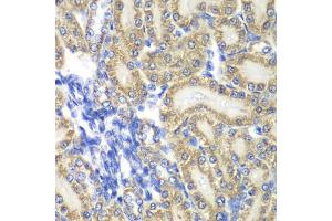 Immunohistochemistry of paraffin-embedded rat kidney using PTGES2 antibody (ABIN5974292) at dilution of 1/100 (40x lens).