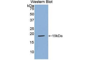 Western Blotting (WB) image for anti-Adrenomedullin (ADM) (AA 31-187) antibody (ABIN1172572) (Adrenomedullin Antikörper  (AA 31-187))