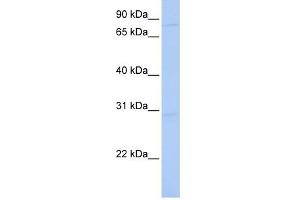 HNRNPU antibody used at 1 ug/ml to detect target protein. (HNRNPU Antikörper)